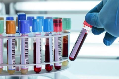 Quận Ba Đình: Rà soát, lập danh sách quản lý, xét nghiệm cho người từng đến thành phố Đà Nẵng